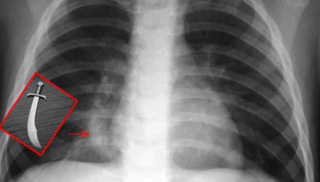 radRounds Radiology Network tweet media