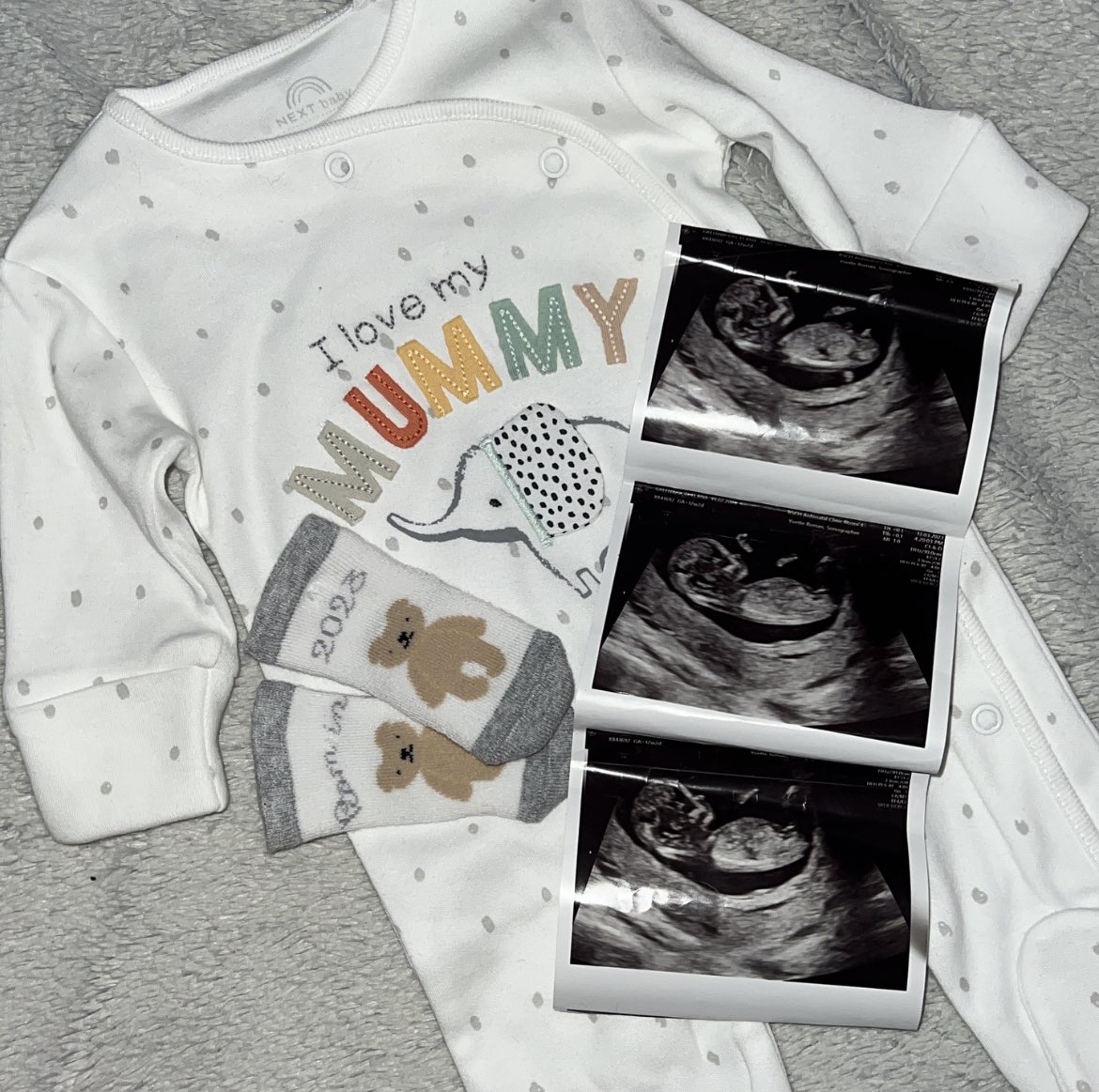 virgilpml's tweet photo. sometimes the best things are the ones that you don’t expect…☺️🍼💜 https://t.co/VHe2YjZWHN