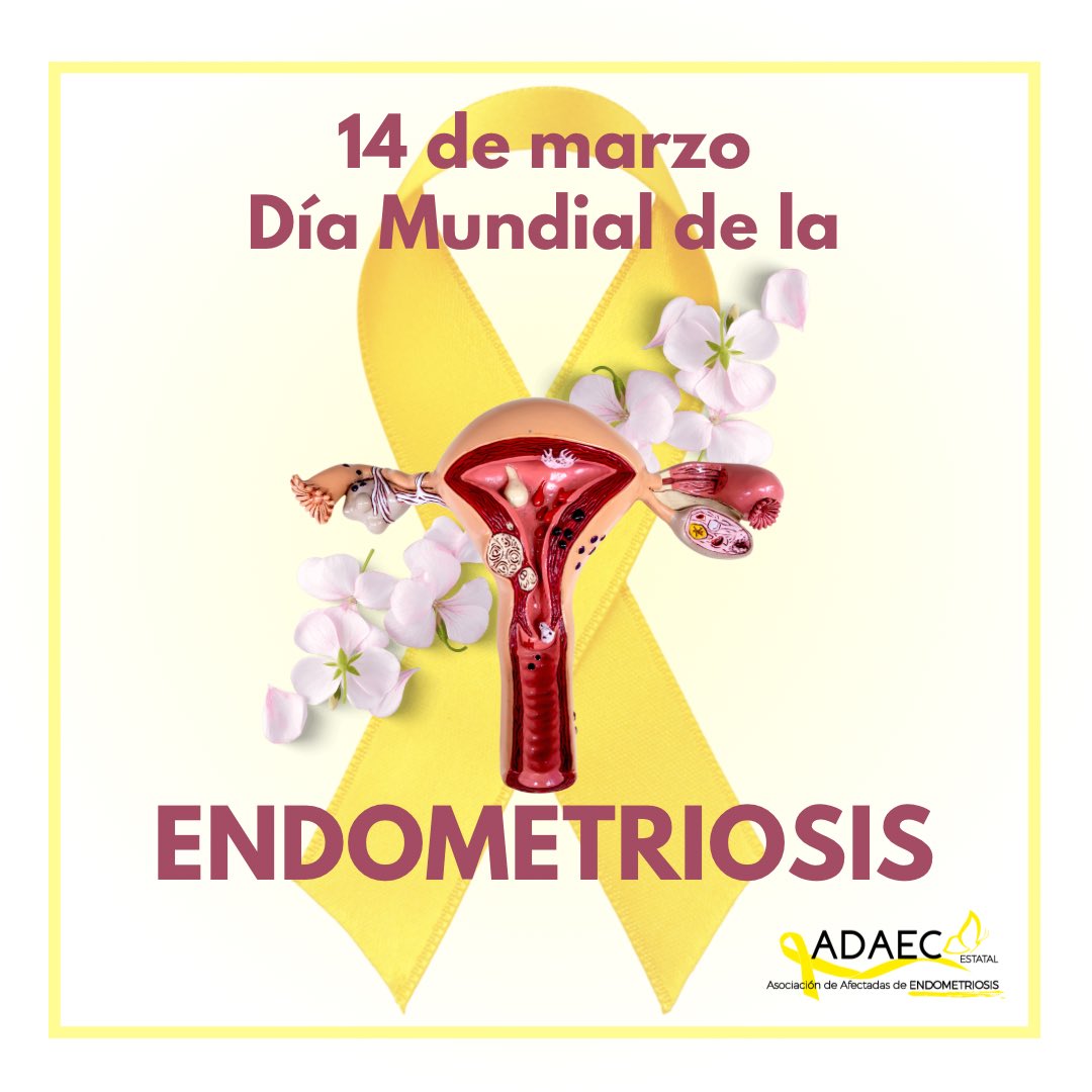 adaecestatal's tweet photo. 🌻La endometriosis es una enfermedad caracterizada por el crecimiento, fuera del útero, de un tejido similar al endometrio, lo que puede provocar dolor, infertilidad o ambos.
Es una enfermedad sistémica, crónica y a menudo progresiva que puede llegar a ser incapacitante. https://t.co/2PHhqoVyVc
