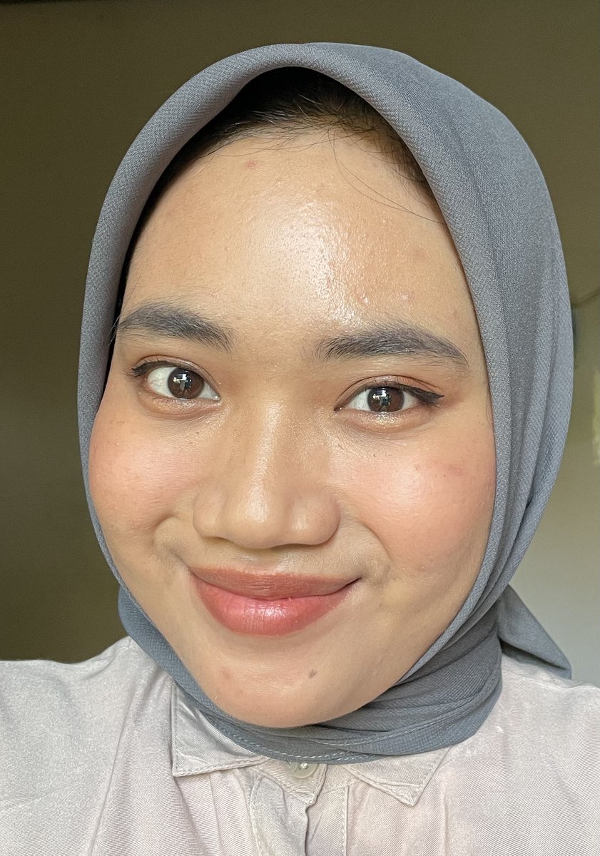 2026akukayaraya's tweet photo. SUKA BANGET SAMA SPOT CONCEALERNYA ADARA😭🫶

Namanya Spot Eraser 2 in 1 Acne Treatment + Concealer. Dia emg bukan type yg high coverage tapi buat aku yg lagi jerawatan dimana-mana ngga bikin jerawat gatel dan finishnya kaya second skin. Super duper nyaman✨

Simak yaa~ https://t.co/Xtvkmt4M4H