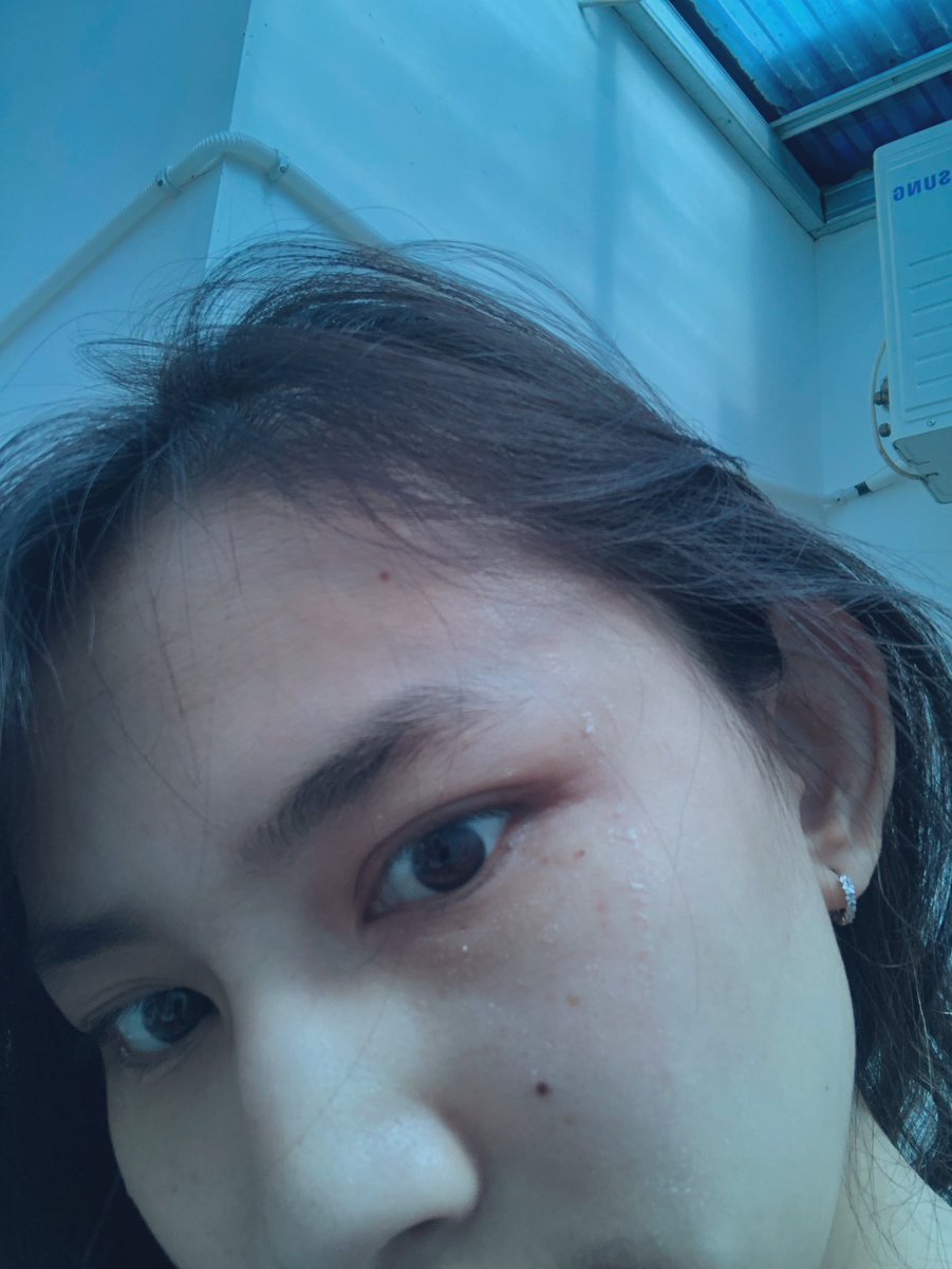 thisfrieska's tweet photo. struggle dengan kulit w yang dry bgt dry https://t.co/35h2Uno7wA