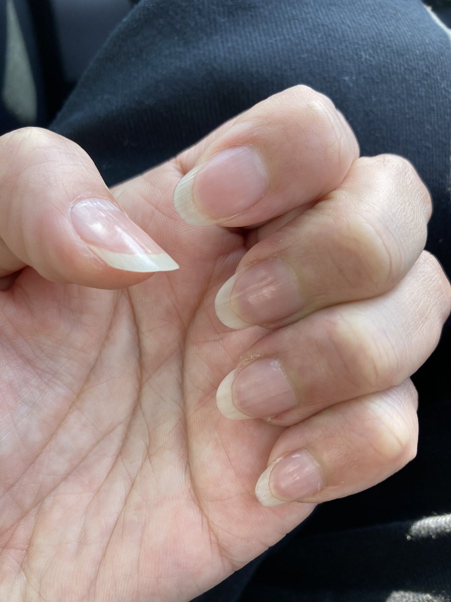 そろそろ自爪きろっと！