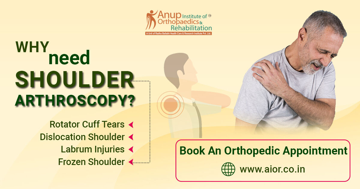 Why Need Shoulder Arthroscopy?

#patnadoctor #patnahospital #orthopaedicdoctor #frozenshouldersurgery #bankartlesionrepair #arthroscopyshoulder #shoulderpain #rotatorcuff #rotatorcufftear #frozenshouldersurgery  #arthroscopyshouldersurgery #drashishsingh #shoulderarthroscopy