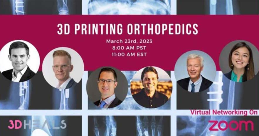 AmnovisOfficial's tweet image. Follow webinar '3D Printing for Orthopedics' featured by @3dheals. Our CEO @rubenwauthle discusses 3D printing innovations in #titaniumimplants &amp;amp; #surgicalguides 👉 bit.ly/3YQkyfM Subscribe 👉 bit.ly/3ZL7MR7 #3dprinting #medicaldevices #orthopedics @radbuzzz