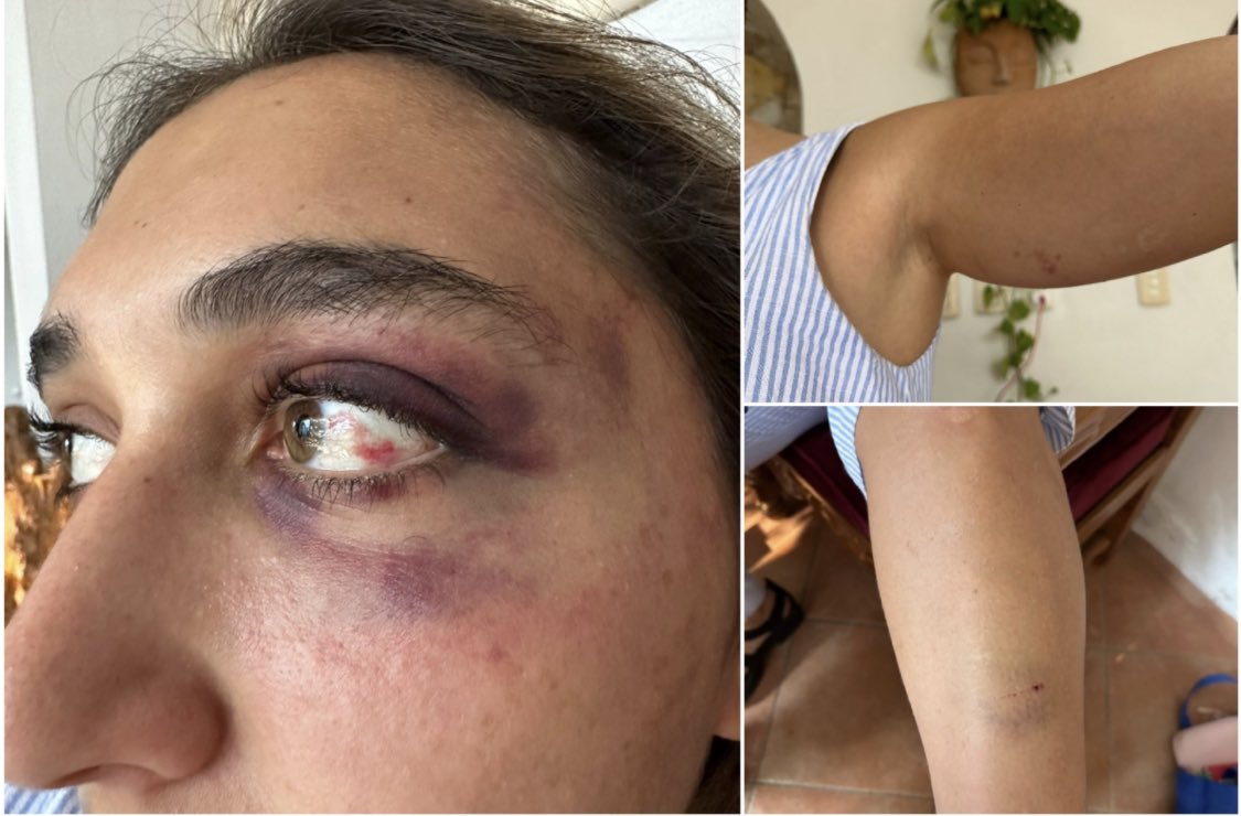 DirMegamedia's tweet photo. ESCÁNDALO EN REDES | Habrían detenido a sobrino de alta funcionaria del gobierno de #Yucatán por agredir a una mujer. Discusión el domingo que derivó en agresiones: https://t.co/QtnPrNdSak #DYInforma #PeriodismoINDEPENDYENTE https://t.co/z43GrDMz1W