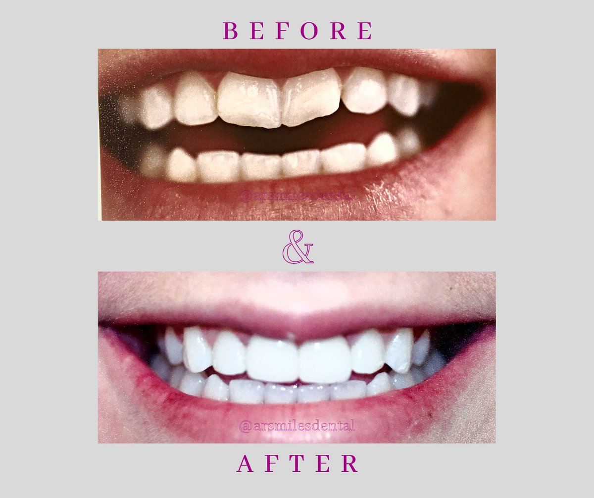 Dr. Sima F. Chegini and her team are committed to providing patients with solutions to improve the aesthetics and functionality of the smile. arsmilesdental.com 
#Dentist #ArsmilesFamilyandCosmeticDentistry #Fairlawn #Ohio