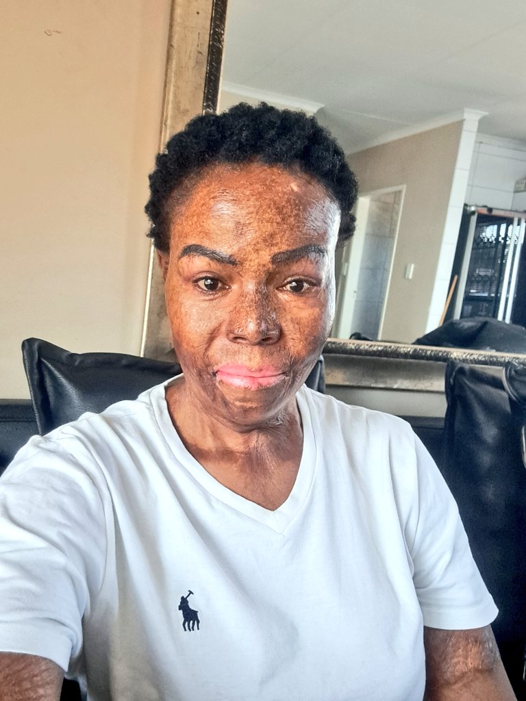Misst_Thembs's tweet photo. It marks 13yrs today since I lost my daughter and brutally torched by the man I thought he loved me...wanting to leave him I didn't know will escalate in him wanting to kill us because we belonged to him...
Domestic violence is real... https://t.co/ePqOJAMAJX