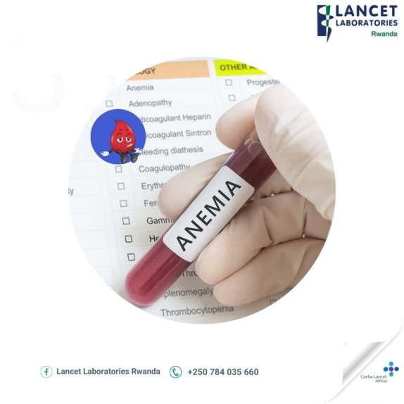 When it comes to detecting blood-related illnesses and infections, such as Anemia, hematology can be an essential tool.

Book with us today on: +250 252 582 901/ 784 035 660 or send us an email at info@lancet.co.rw
#Bloodtesting
#Anemia
#hematology