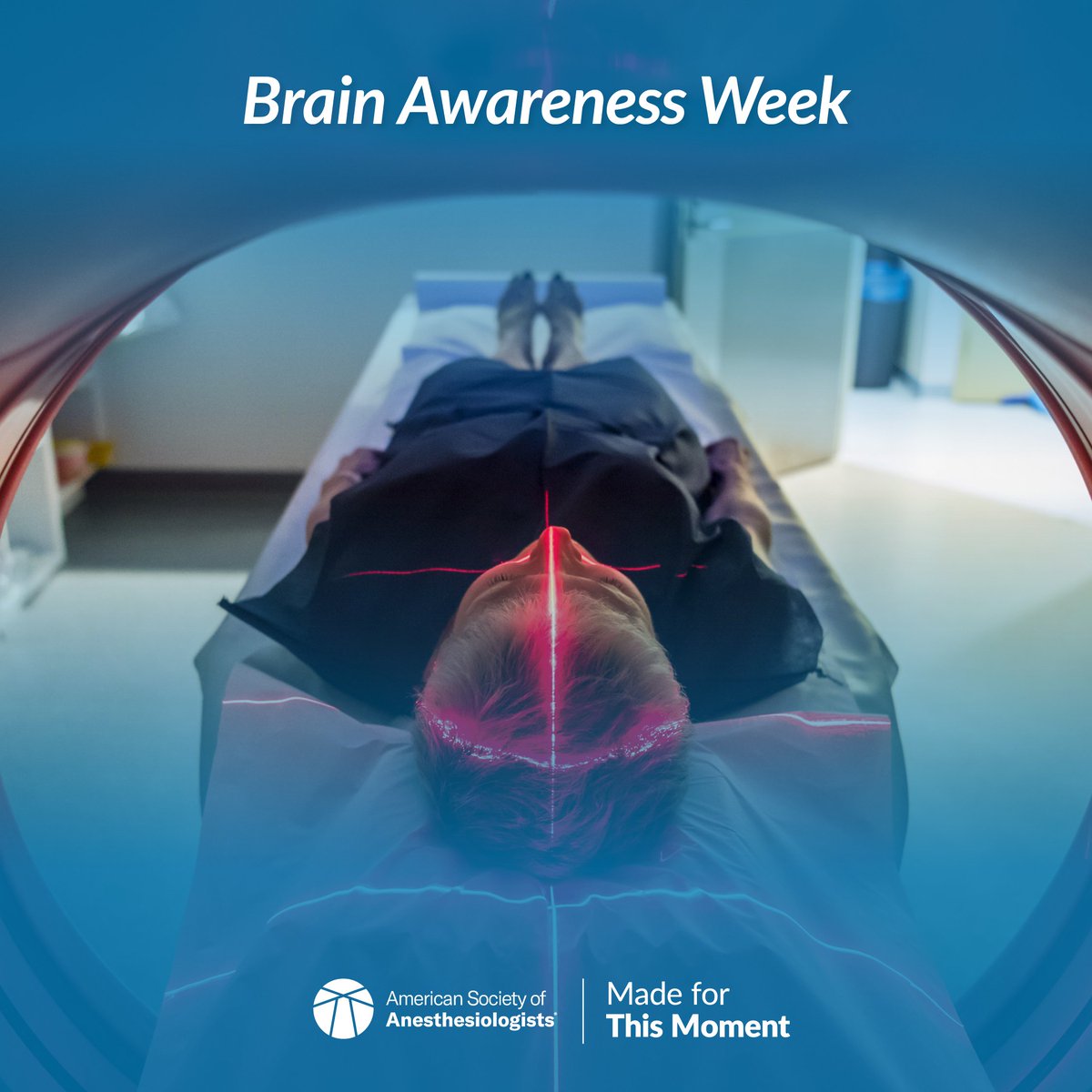 ASALifeline's tweet image. It’s #BrainAwarenessWeek! 🧠

Keeping your brain healthy before and after surgery is crucial. Learn how to avoid potential surgical complications with resources from ASA’s Perioperative Brain Health Initiative:
ow.ly/VNP150Nfx1a

#BrainWeek