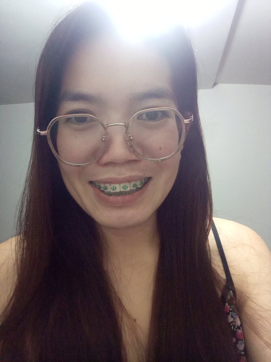 Rolieme22's tweet image. 93rd day of braces 😁

#overbite