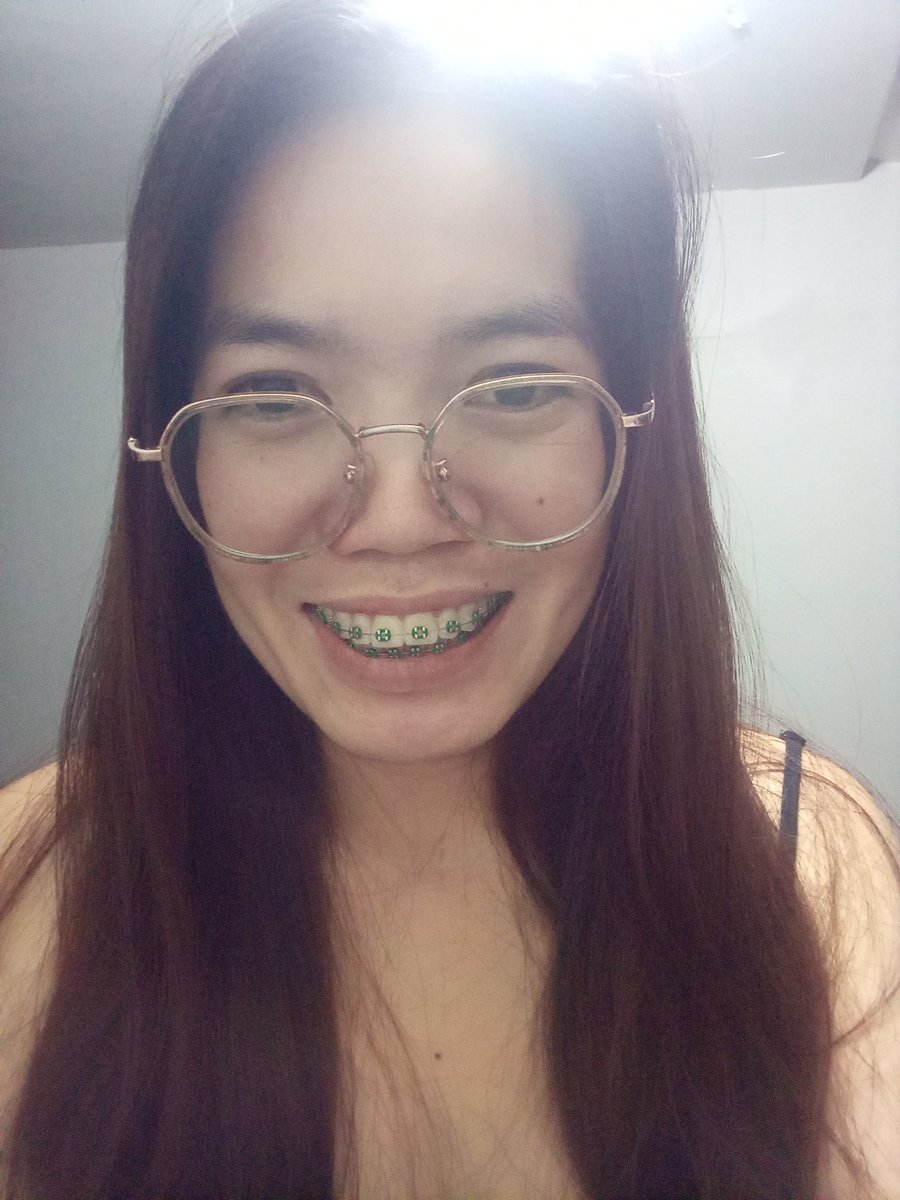 Rolieme22's tweet image. 93rd day of braces 😁

#overbite