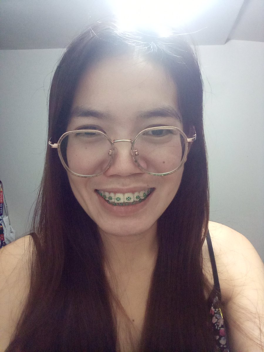 Rolieme22's tweet image. 93rd day of braces 😁

#overbite