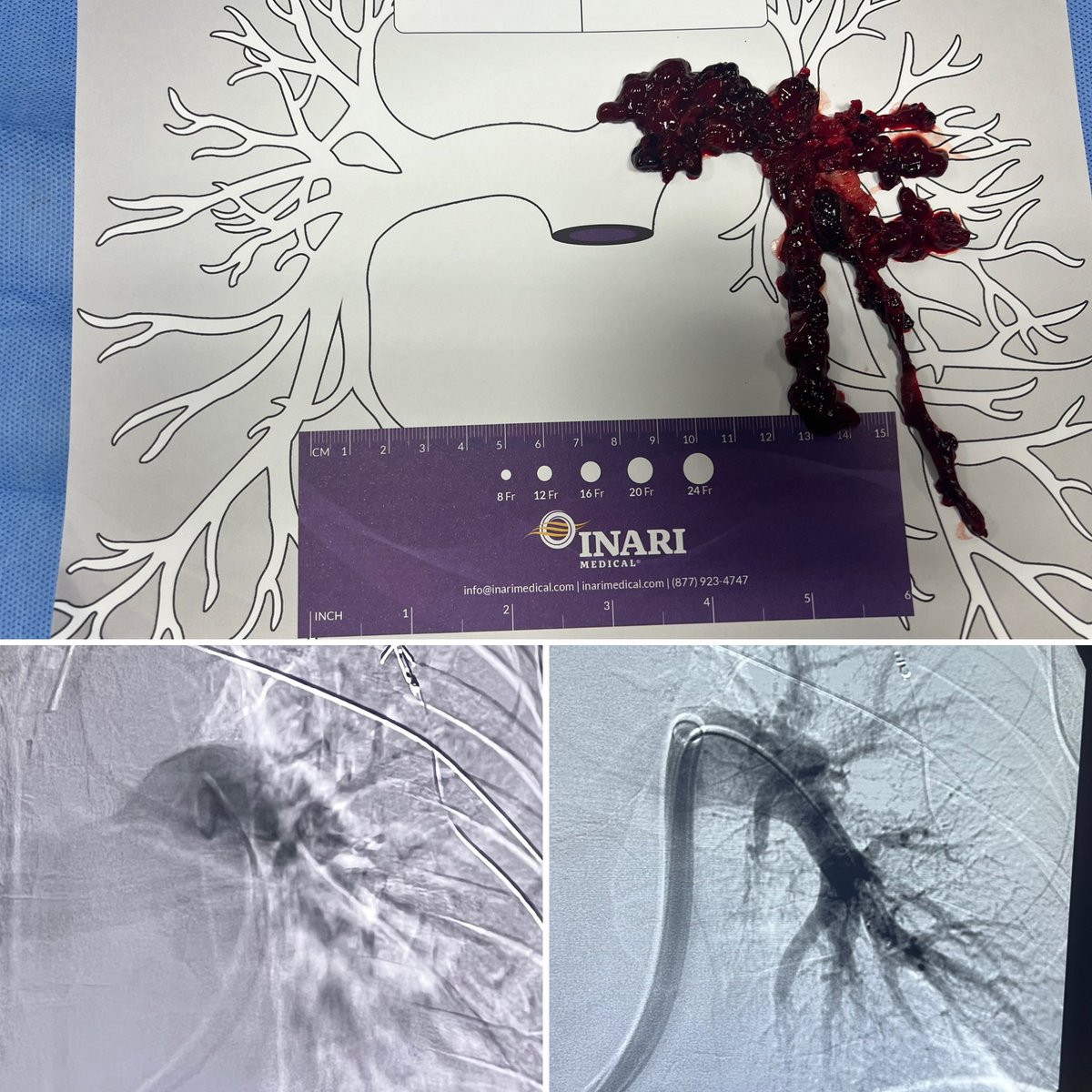 Lisa Rubenstein, MD. tweet media