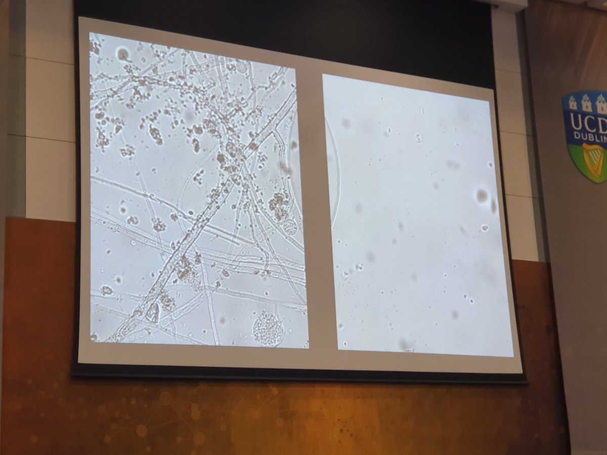 What an amazing talk by Edith Hammer ! -Looking at soil microbes on a microchip, guess which chip is the ploughed field vs grassland???