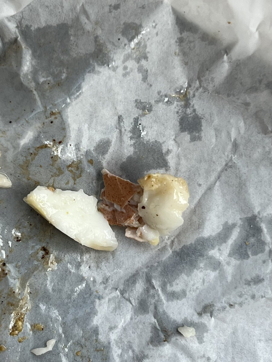 millycarlton's tweet photo. @McDonaldsUK found a nice chunk of shell in my sausage and egg mcmuffin this morning!! https://t.co/J4scwHD3a2