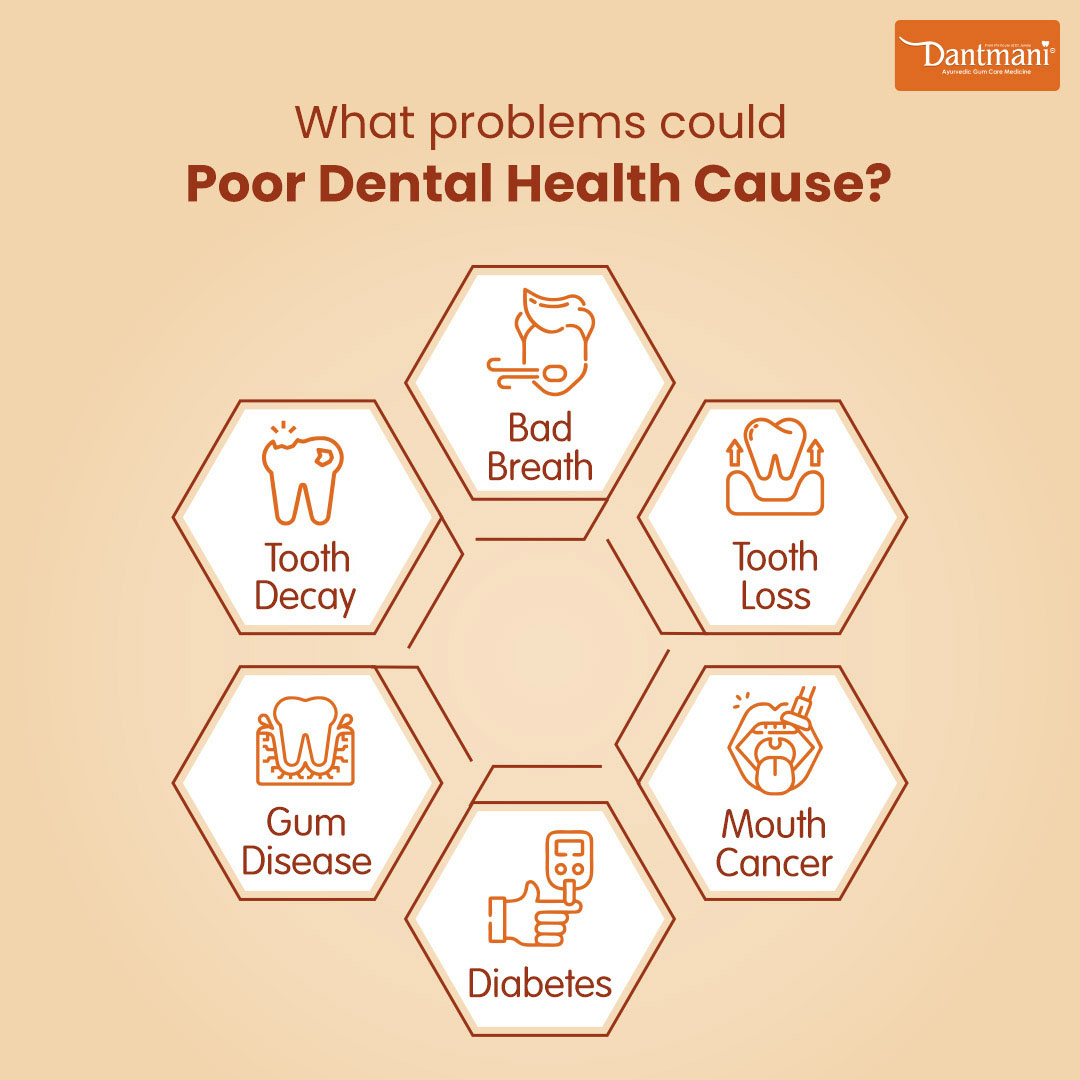 DantMani's tweet photo. Now that we have located the problems associated with poor dental care, let’s ensure we take regular care to avoid them as much as possible. #dantmani #toothcare #dentalcare #cavityfree #healthygums #toothcaretips #dantmaniayurvedic https://t.co/SiS3pMYrbi