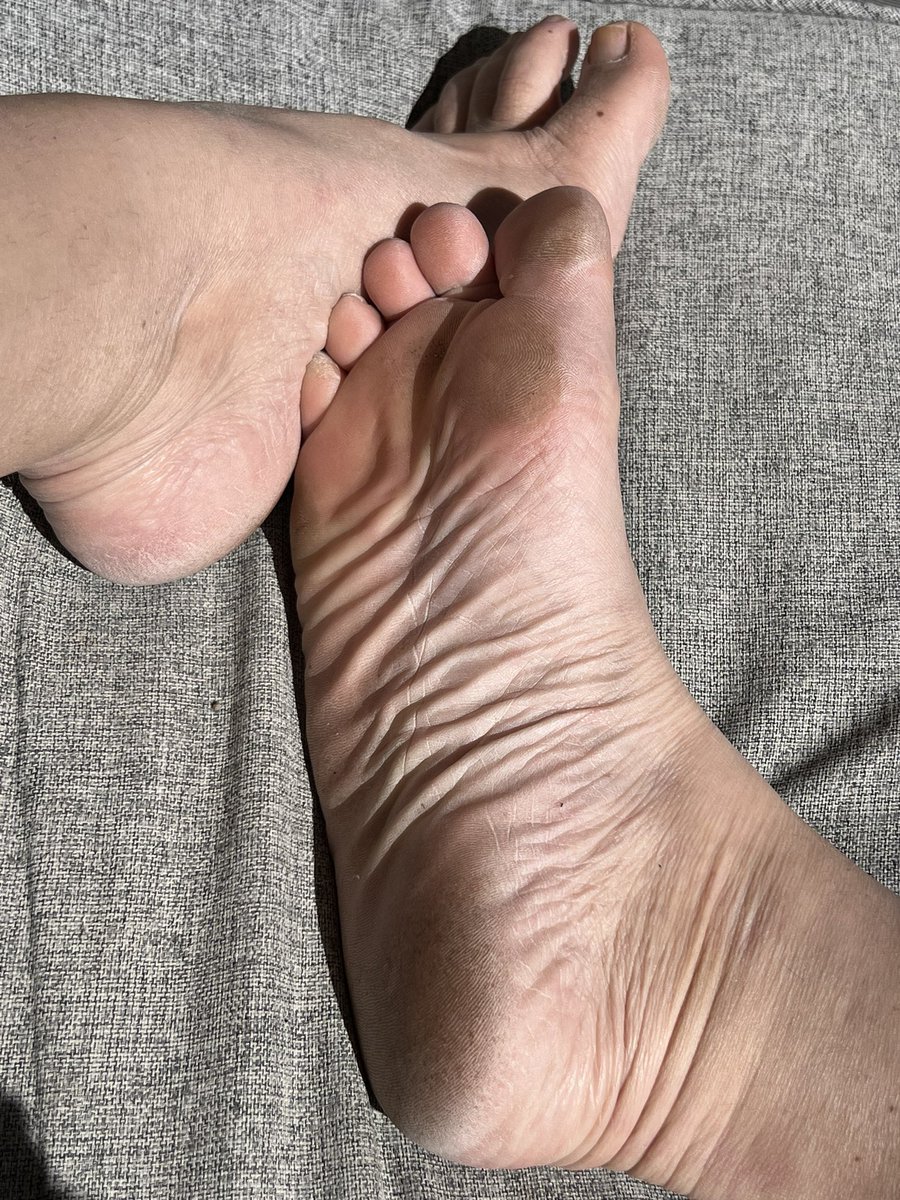 QueenNakoma's tweet photo. My perfect big feet kissed by the Sun what a perfect moment! @Brun0Parent @RTpeasant123 @blosom_rtsub @RTmutt90 https://t.co/v1fImgNF70
