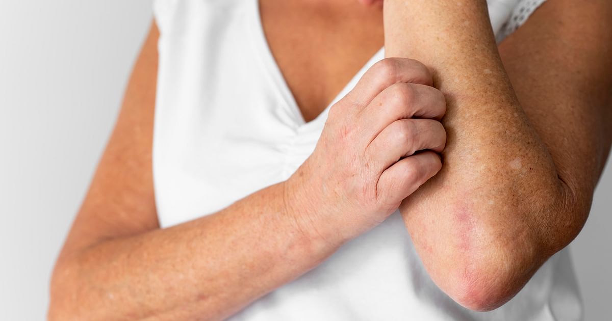 Eli Lilly Forays Into Dermatological Space With Launch Of Psoriasis Drug dlvr.it/SksWb8 #digitalhealth #socialmedia #digitalmarketing #AI #industry40 #IoT #mhealth #healthtech