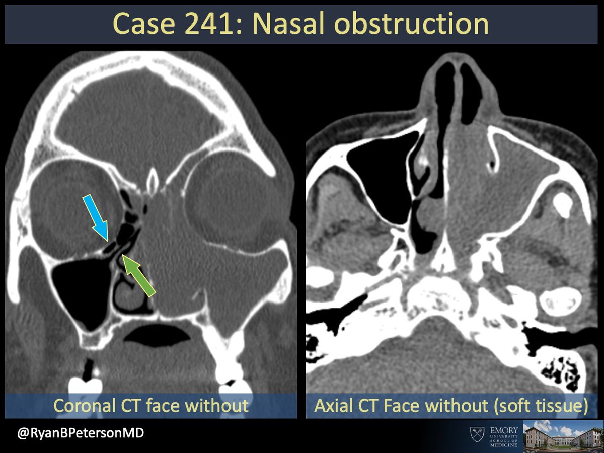 Ryan B Peterson 🇸🇪 tweet media