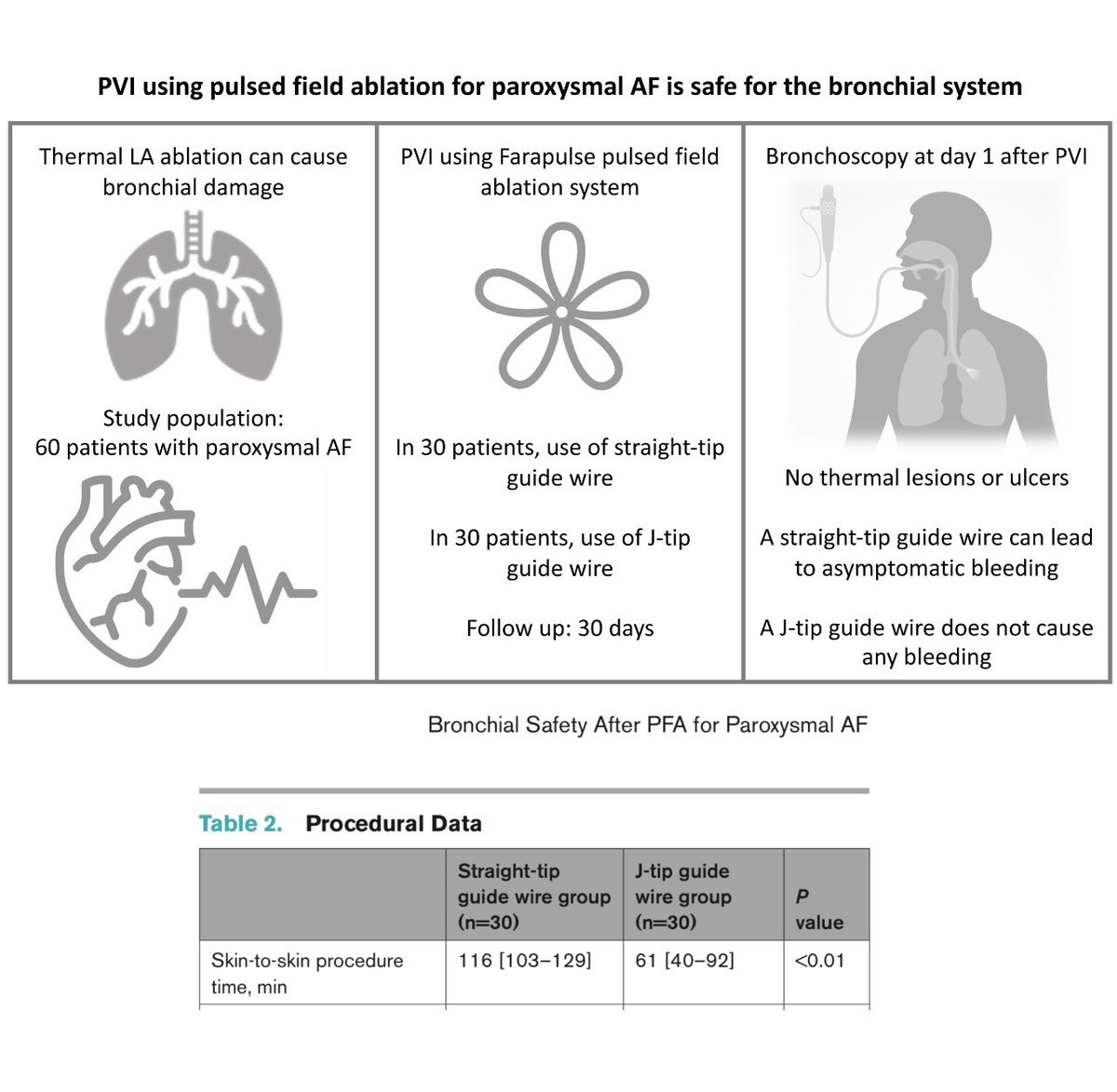 Stiff- vs J-wire guided PFA: it’s about safety or even efficiency 
Füting/Neven etal <a href="/CirculationEP/">CircEP</a> 
we use J as standard😉
<a href="/S_NarayanMD/">Sanjiv Narayan</a> <a href="/netta_doc/">JK Han MD</a> <a href="/purerfellner/">Dr. Helmut Pürerfellner</a> <a href="/DrRoderickTung/">Roderick Tung</a> <a href="/ftrae/">Piotr Futyma, MD</a> <a href="/LuigiDiBiaseMD/">Luigi Di Biase</a> <a href="/hhuang123/">Henry D. Huang</a> <a href="/BA_Mulder/">Bart Mulder</a> <a href="/javadm20/">javad mikaeili</a> <a href="/Ed_Gerst/">Edward Gerstenfeld</a> <a href="/Drdevignair/">Dr. Devi G Nair</a> <a href="/EladAnter/">Elad Anter</a> <a href="/jskoruth/">Jacob Koruth</a>