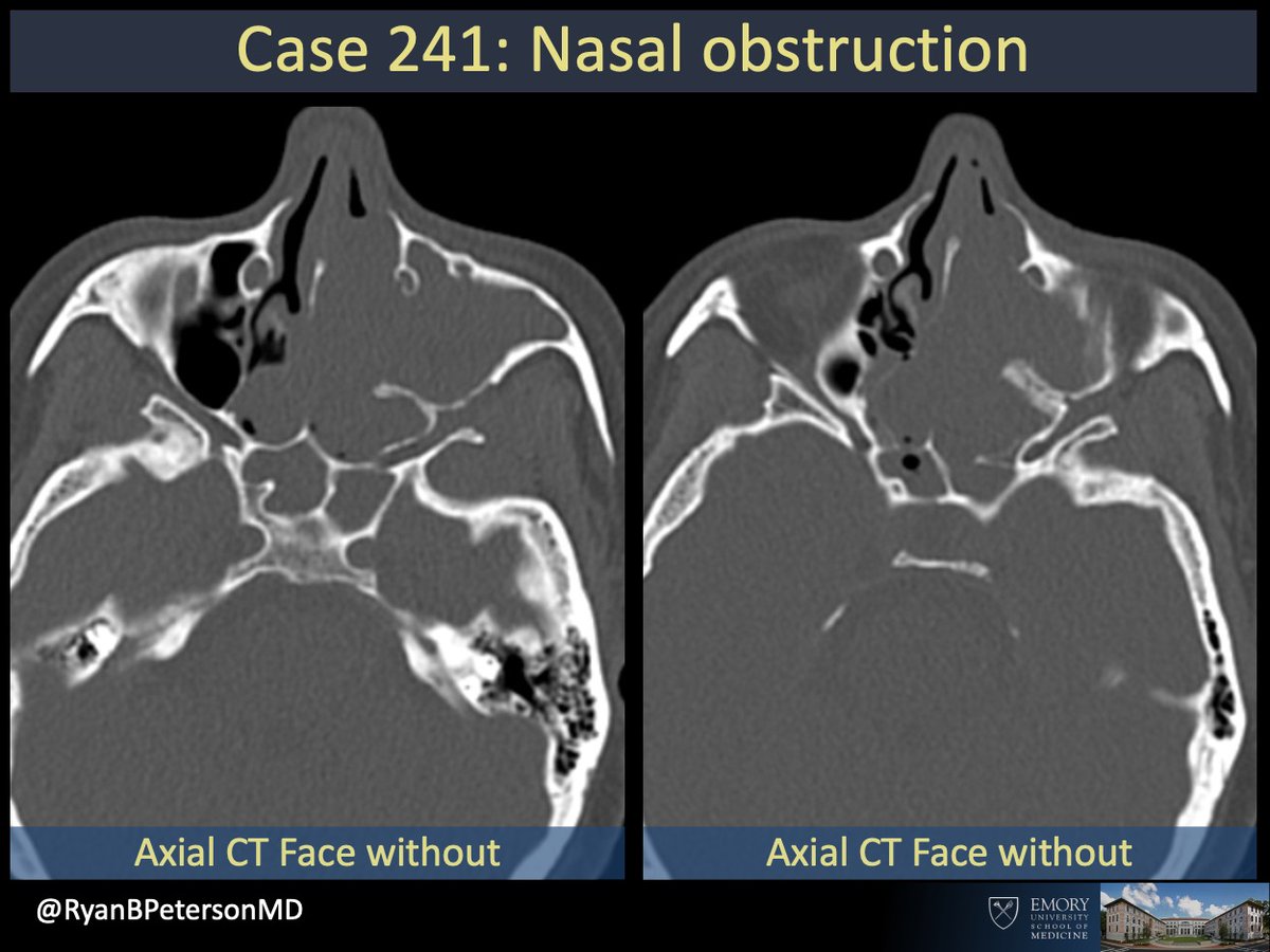 Ryan B Peterson 🇸🇪 tweet media