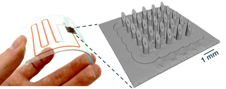 lammertyn_lab's tweet image. 📣 #JustPublished:
@VanHileghemL et al's work on an innovative way of #hollow #microneedle arrays fabrication for #blood #sampling on a autonomous #microfluidic patch 👨‍⚕️

👉Read here: ow.ly/cypb50Nfbj8

@KU_Leuven @biosystkuleuven @FWOVlaanderen @KUL_Postharvest