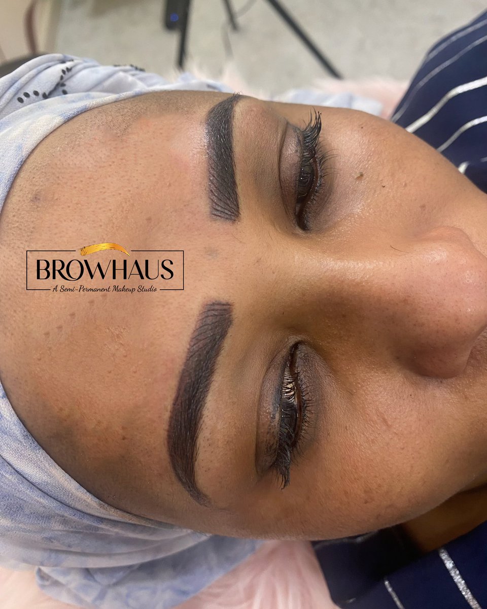 Eyebrows don't hide your emotions well! ...

#damagedbrows #pmubrows #microbladingeyebrows #repairwork #eyebrowrepair #eyebrowdamage #dontfallforcheaptricks #choosebest #hyderabad