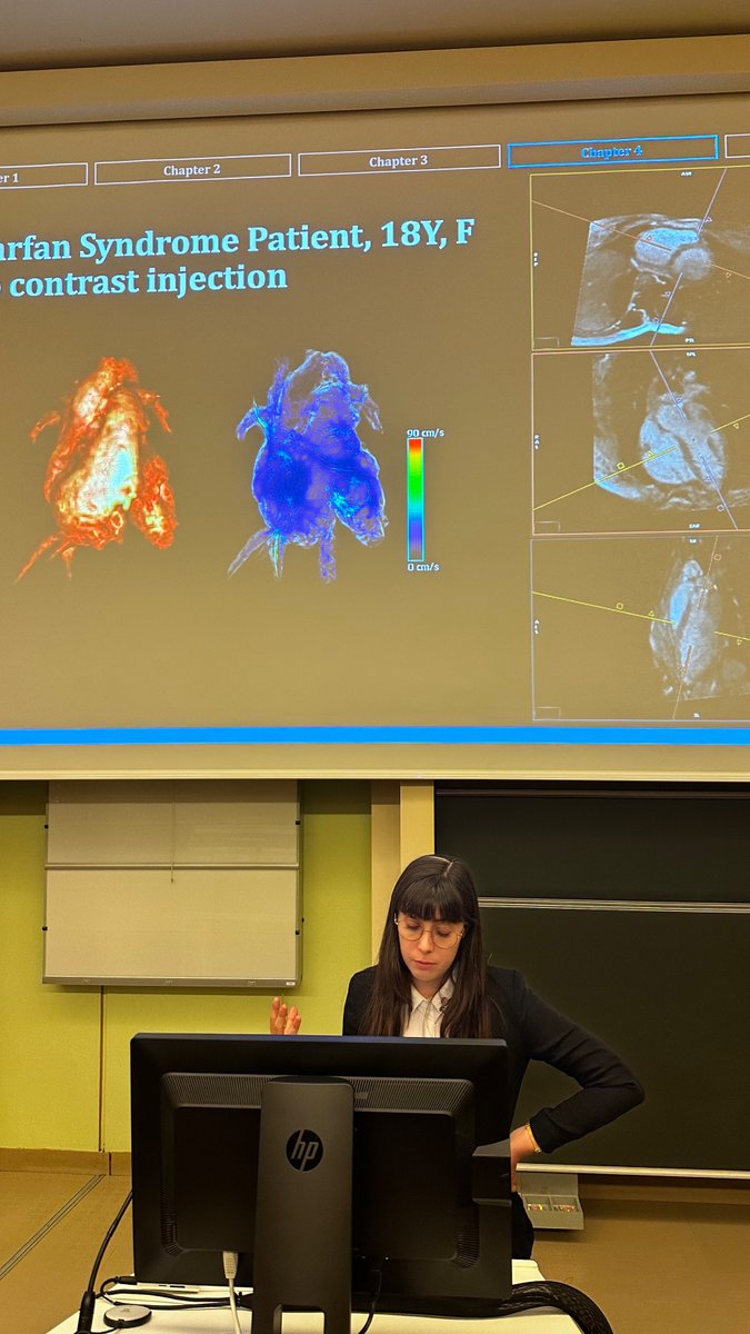 Congratulations to Mariana Falcão for a very successful Ph.D. thesis defense on "High-Dimensionality Free-running Cardiovascular Phase Contrast MRI applications" #freerunningrunningfreely #SNSF