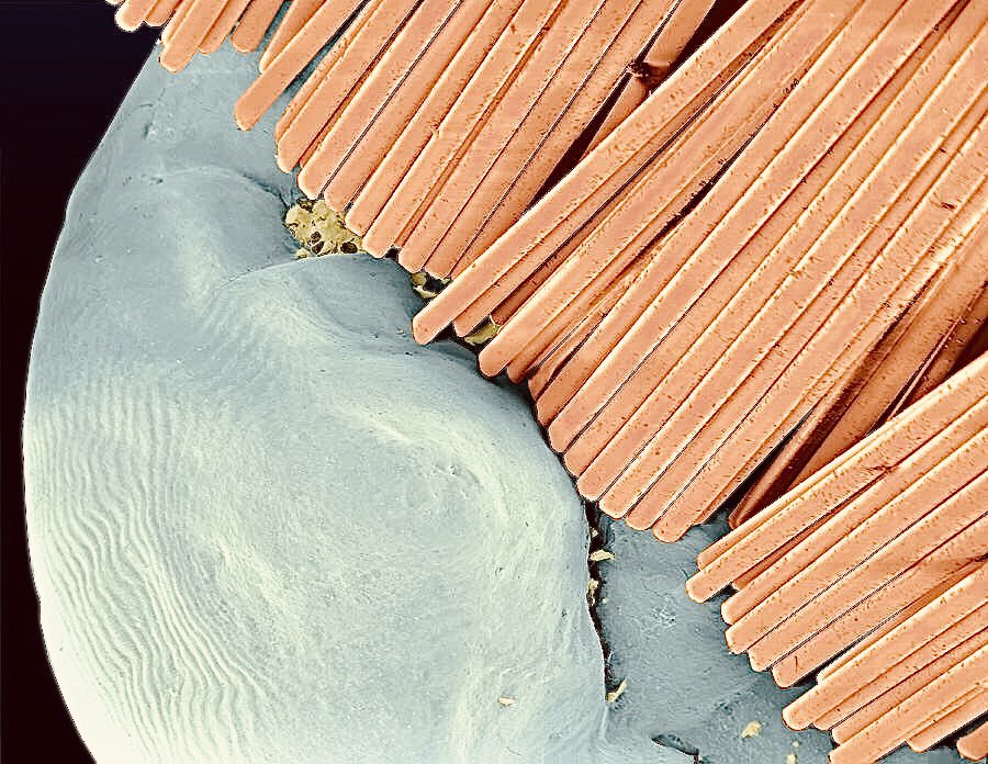 microscopic images. on Twitter "electron microscope image of a