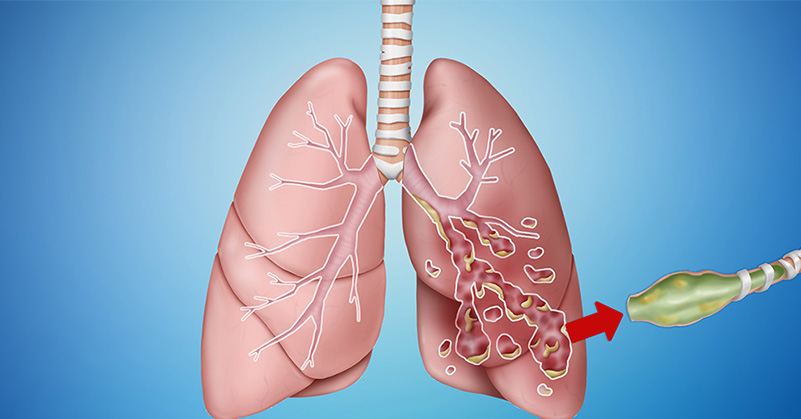 PeerView's tweet image. Attention #Radiologists and #Pulmonologists! Join our experts Charles L. Daley, MD, &amp;amp; Mary M. Salvatore, MD, in Honolulu, Hawaii on April 16th for this one-of-a-kind #NCFBE #MedEd symposium! bit.ly/NCFBE23T #Radiology #Pulmonology #MedEd #MedTwitter