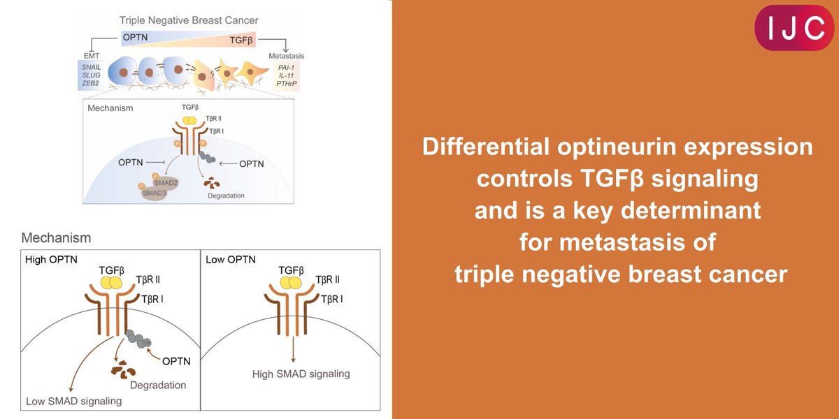 NOW ONLINE

The <a href="/PtenDijkeLab/">ten Dijke Lab</a> found that low expression levels of optineurin in triple-negative #BreastCancer are correlated with higher metastasis incidence, making it a potential prognostic indicator to stratify patients

🔓OPEN ACCESS
➡️doi.org/10.1002/ijc.34…