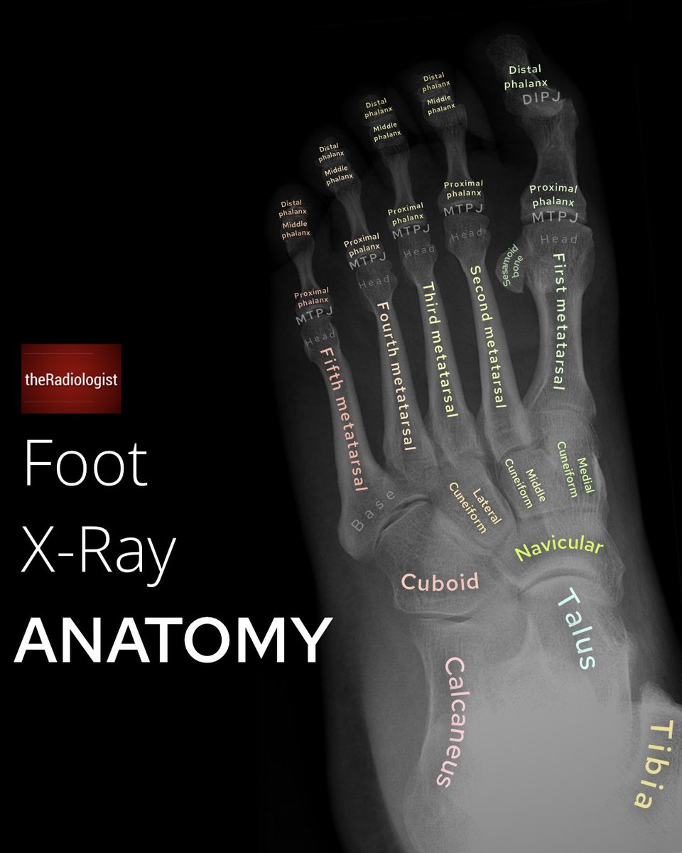 Foot XRay anatomy and review areas 🧵 1/3 Thread from theRadiologist radiologistpage Rattibha