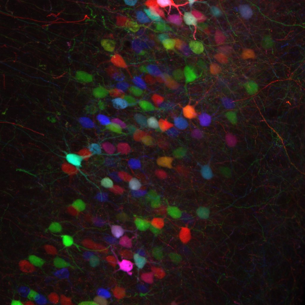 First time testing the tet-bow system in the lab and we got this image! Pure joy!! Image credit to @KMoanNeuro. #QuattrocoloLab <a href="/KISNeuro/">Kavli Neuroscience</a>