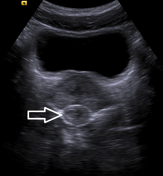 EcosemFYC tweet media