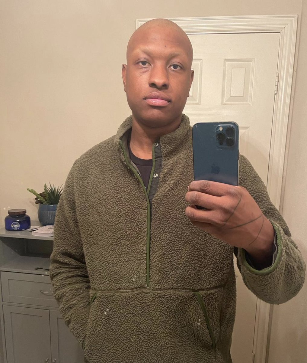 AndreRiggins_'s tweet photo. @TrintheGem It will grow back, don't worry.  For example, I shaved my eyebrows on Christmas. The second pic is January 11th. Eyebrows take a little longer. https://t.co/lt8I2s4jKA