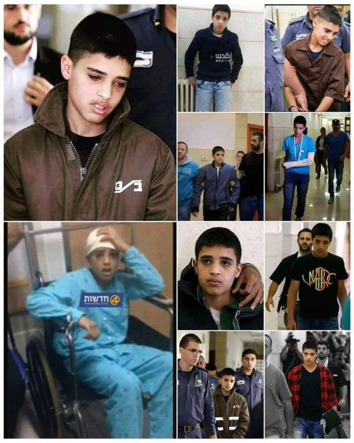 12 yaşında vurularak tutuklanan ''Ahmad Manasra'' yıllardır tek kişilik hücrede tutuklu kalıyor, dün ise işgalci israil mahkemesi tek kişilik tutuklanmasının devamına karar vermiş, Ahmad sağlık ve psikolojik problemleri yaşıyor..