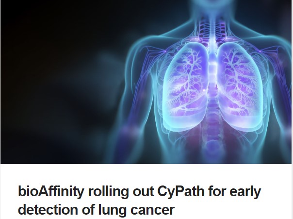 bioAffinity's tweet photo. #BioTuesdays, the website that spotlights #healthcare companies and their stories, today features #bioAffinity &amp; our #CyPathLung test for early-stage #lungcancer.  Read the story at https://t.co/CS1iMIE4bd  
#cancerscreening #lunghealth #earlydetection https://t.co/h73TUlfS0y