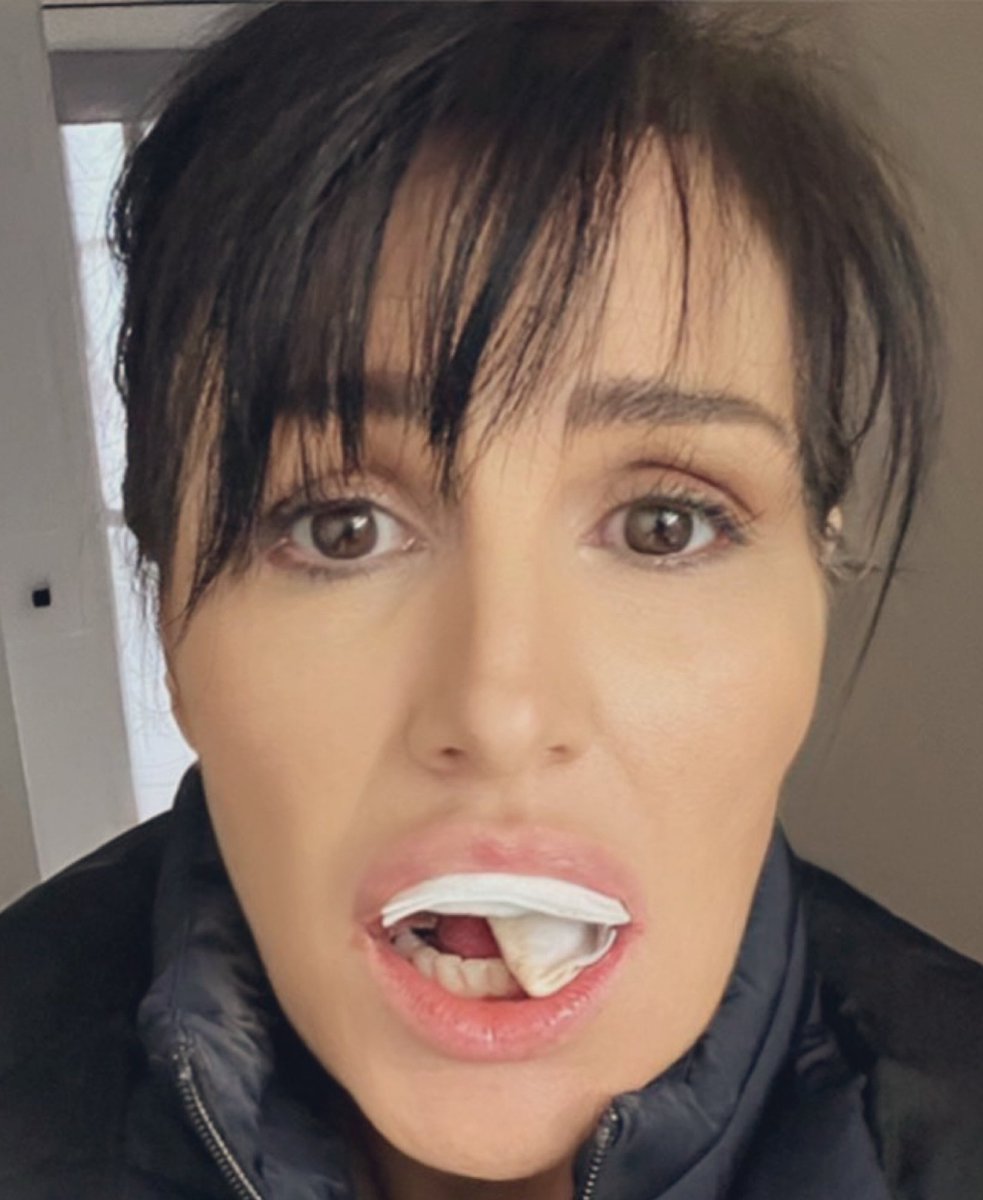Gina Levy On Twitter Fuck The Dentist