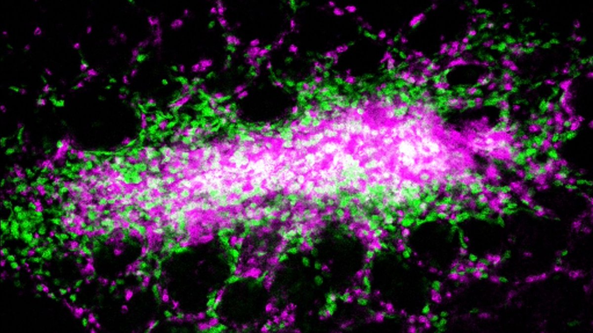 Penn Vet (@pennvet) on Twitter photo Researchers at #PennVet uncover a battle between the #immunesystem and Yersina bacteria, a relative of the bacteria causing gastrointestinal disease and the plague. 
The insights could inform the development of immunotherapies. 
Read more: bit.ly/3yDEBDG Researchers at #PennVet uncover a battle between the #immunesystem and Yersina bacteria, a relative of the bacteria causing gastrointestinal disease and the plague. 
The insights could inform the development of immunotherapies. 
Read more: bit.ly/3yDEBDG