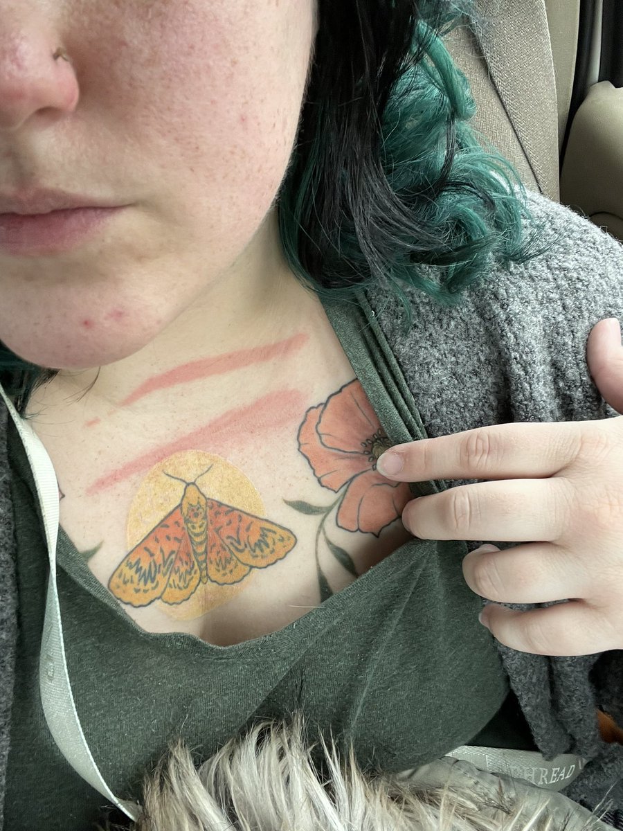 kGRRsten's tweet photo. I burned myself at work today. Give me attention to make me feel better. https://t.co/57yxqfKmXT
