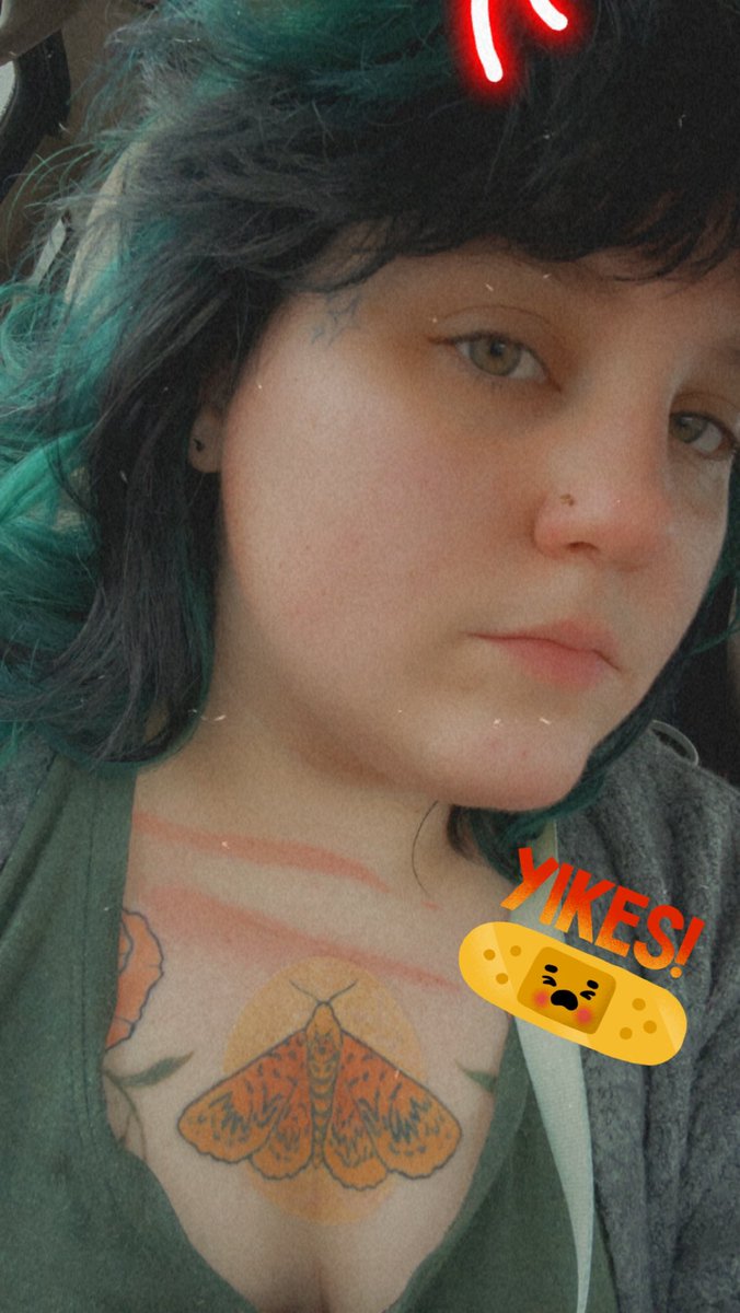 kGRRsten's tweet photo. I burned myself at work today. Give me attention to make me feel better. https://t.co/57yxqfKmXT
