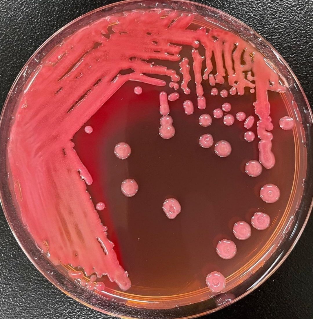 MicrobZoo's tweet photo. ⭐Enterobacter aerogenes and Enterobacter cloacae; versatile bacterial pathogens confronting antibiotic treatment

✨ Read more: https://t.co/EfKEG9QlaT https://t.co/X3XehlH4gv