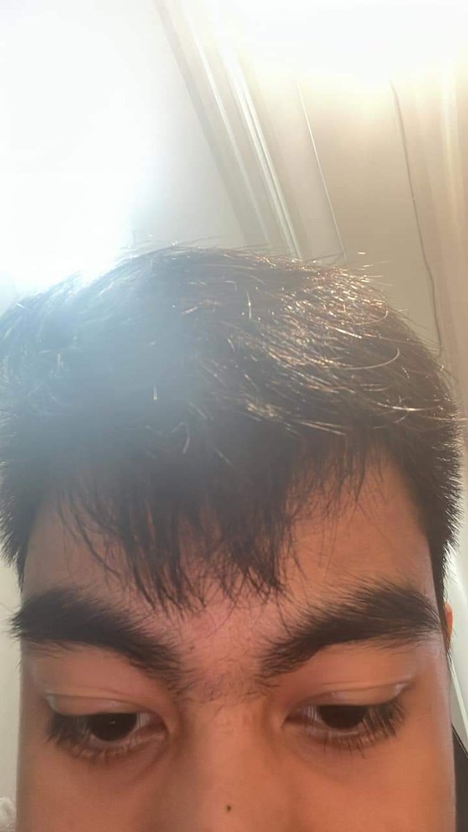 shin_sayshi's tweet photo. To our cutie bunso, @red_bordeos15

Heartiest birthday greetings to the coolest, down to earth, and cutest person I know. Wishing you a year of success, happiness, and peace. Today is your special day so enjoy and have a blast! 🥳🎂🫶🏻

#HappyRedDay https://t.co/FMTMQu5O5N