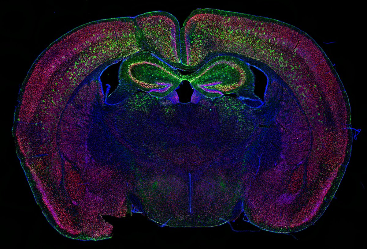 Image of a 🐁 brain acquired with fluorescence microscopy. 

“Tagging inhibitory + excitatory neurons with different fluorescence markers makes it possible to generate an atlas of an entire piece of brain tissue at cellular-level resolution.” -@JFitzpatrickWU #BrainWeek