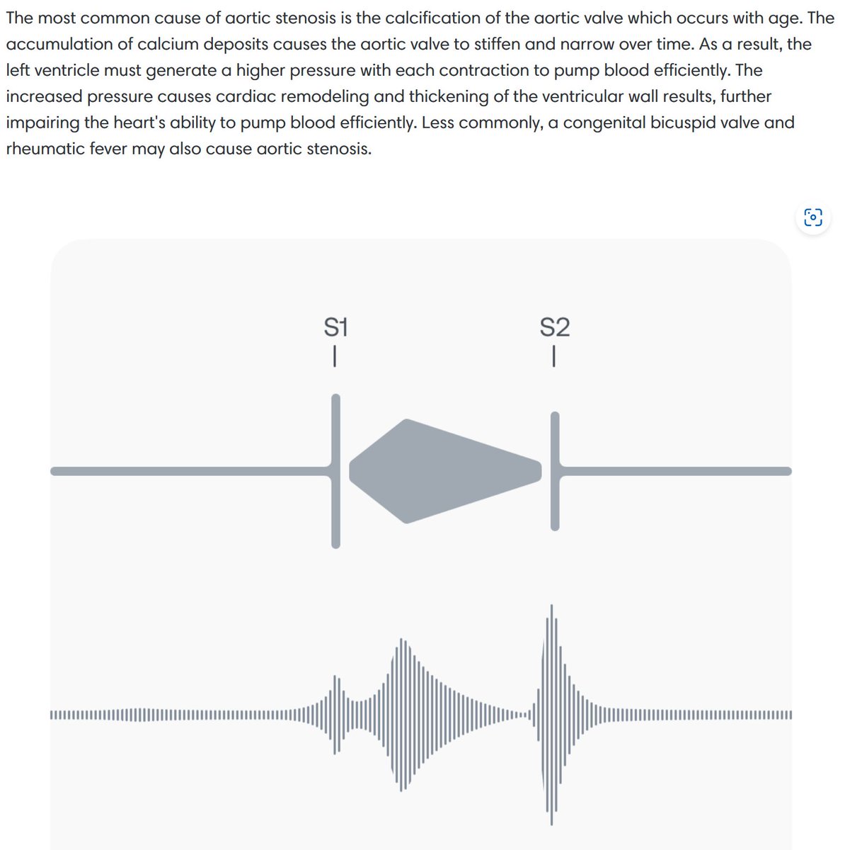 #AorticStenosis #Murmurs 
Murmurs can be difficult to detect and even harder to discern. <a href="/Eko_Health/">Eko Health</a> has great pathology and audio-education tools to help you become more comfortable. 
<a href="/tricianp/">triciaDNP, NP-C, FACC</a> <a href="/LizPerpetua/">Liz Perpetua</a> @heartnpben <a href="/Fortman312/">Kyle Fortman</a> <a href="/VietHeartPA/">Viet Le DMSc PA-C FACC FAHA HF-Cert</a>
🫀⬇️🫀👂
ekohealth.com/blogs/educatio…
