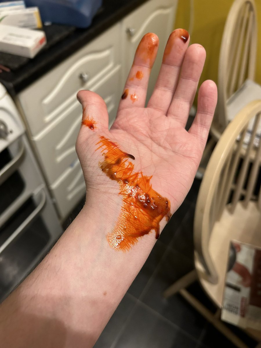 Either I spilled chilli sauce whilst cooking some noodles, or I cut my palm open.

Sadly for my dramatic self, it’s the former.
