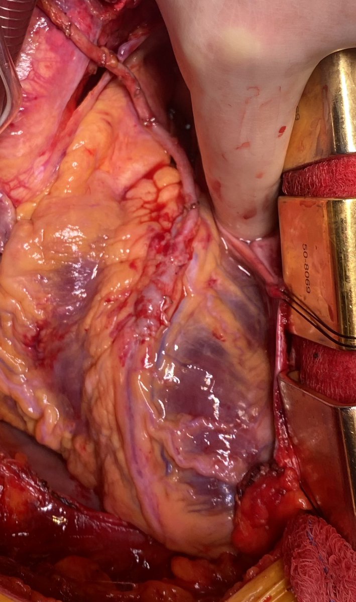 J. Alex Weston tweet media