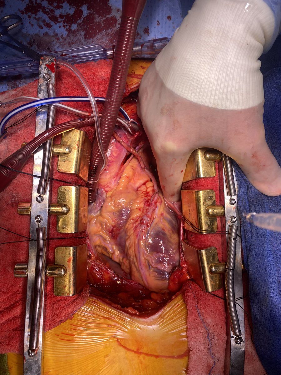 J. Alex Weston tweet media