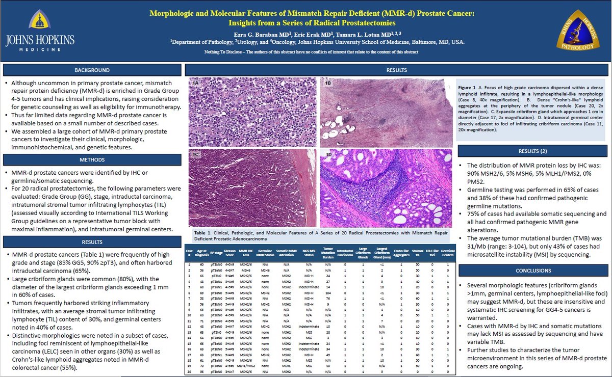 JHUPath's tweet photo. Morphologic and Molecular Features of Mismatch Repair Deficient (MMR-d) Prostate Cancer: Insights from a Series of Radical Prostatectomies https://t.co/p3Mznwb1UV