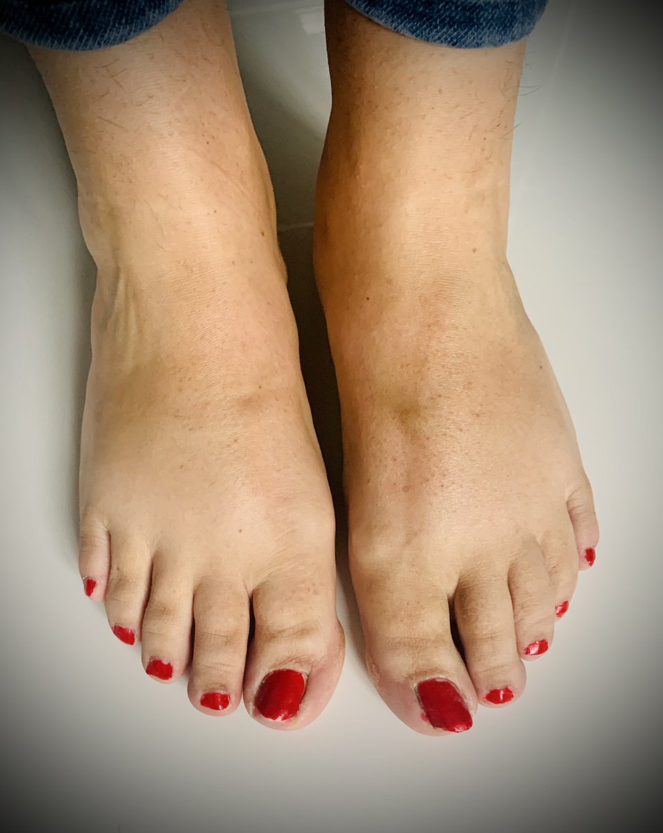 finefootography's tweet photo. Fed up with red now , wondering what colour to have next? #Sellingcontent #feetpicsforsales #requests #smallfeet https://t.co/bq6MgT0FuG